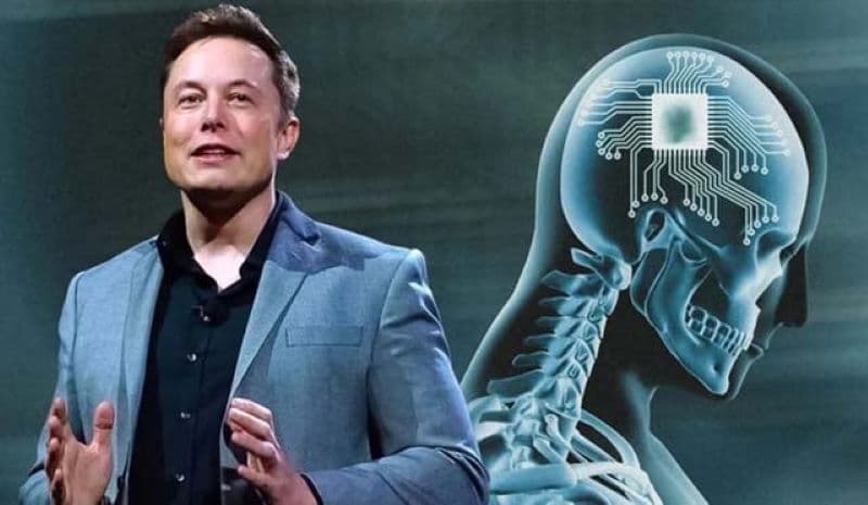 Compania lui Elon Musk a reușit să realizeze primul implant cerebral la om