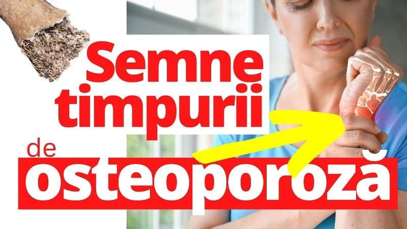 Iată ce trebuie să faci pentru a preveni osteoporoza!