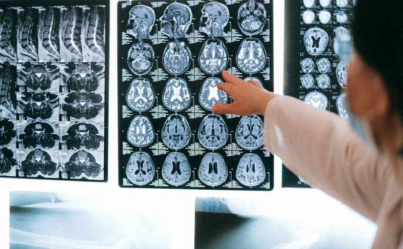 Leziunile cerebrale traumatice. Cum le recunoști și de ce nu trebuie ignorate