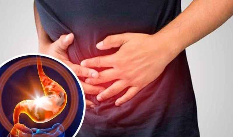 Arsuri la stomac: remedii naturale și sfaturi de prevenție