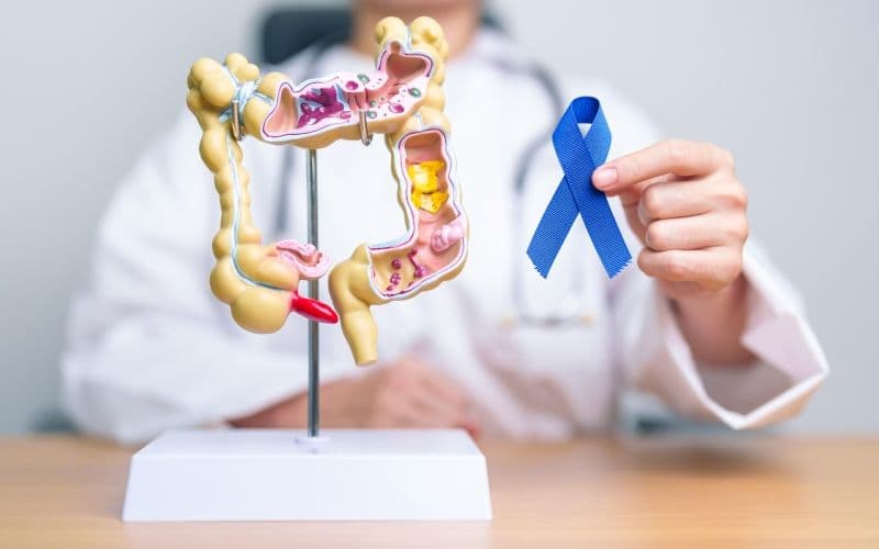 Polipii de colon, sursa de cancer. Cât de des trebuie făcută colonoscopia