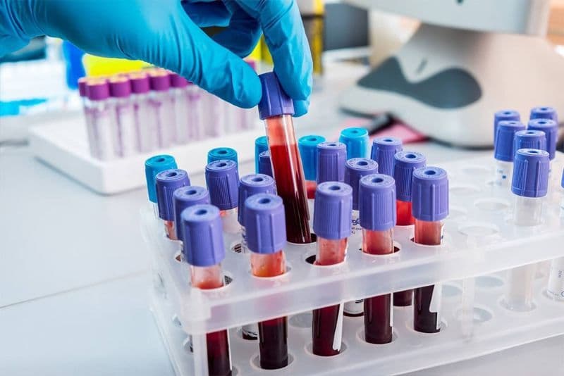 Laboratorul de Analize Medicale al Spitalului Dorohoi introduce analize noi realizate cu aparatură modernă și metode actuale