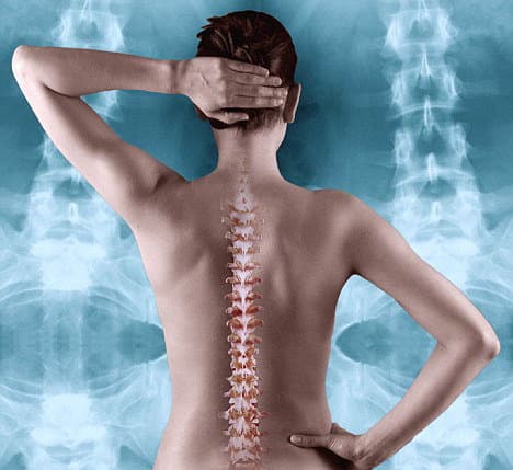 Ce trebuie să faci pentru a preveni osteoporoza!