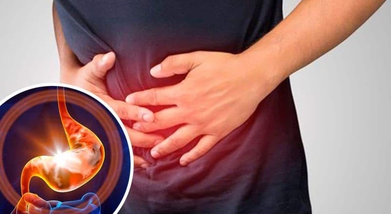 Remedii naturale și sfaturi de prevenție pentru arsuri la stomac