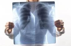 Toți fumătorii trebuie să știe asta. Cel mai bun remediu natural pentru curățarea plămânilor