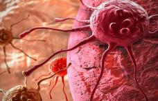 Medicii trag un semnal de alarmă: Lipsa acestei vitamine duce la apariţia cancerului!