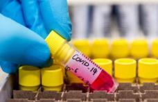 Statistică la nivel național: Peste 150 de cadre medicale și personal auxiliar confirmate cu COVID-19