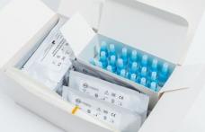 CNSU a aprobat achiziționarea 70 de milioane de teste rapide de salivă pentru utilizarea în unități de învățământ