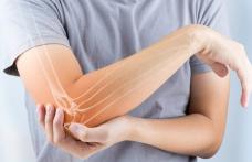 Ce trebuie să faci ca să previi osteoporoza