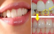Sfaturi pentru a elimina tartrul dentar în mod natural