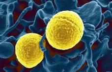 Bacteria care a îngrozit Europa. Se poate lua în autobuz şi îţi poate ataca plămânii
