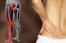 Cum să ameliorezi durerea de nerv sciatic