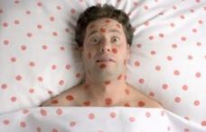 Epidemia de rubeolă amenință România