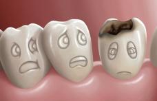 Cel mai bun aliment pentru prevenirea cariilor