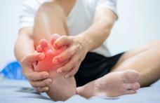 Tratamente naturiste pentru gută