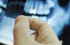Cât de periculoase sunt radiografiile dentare