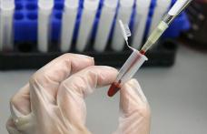 28 iulie Ziua Mondială de Luptă împotriva Hepatitei. Numărul bolnavilor cu hepatită C în creştere