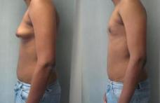 Cât de dăunător este consumul de carne de pui injectată cu hormoni