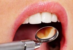 Molarii de minte ne fac mai mult rău decât bine