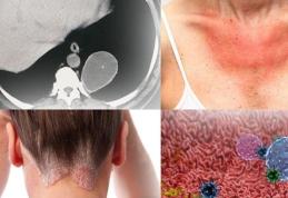 Cele mai grave boli provocate de stres și depresie