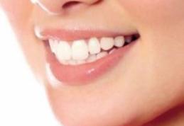 Ce spun dintii despre sanatatea ta?