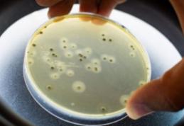 Alertă! Toate lacurile de pe râul Bistrița sunt infestate cu o bacterie periculoasă