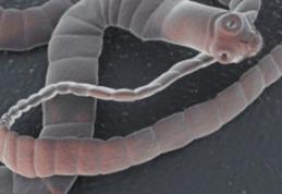 Viermele ce îți poate invada creierul. Cum poate ajunge în organismul tău, din alimentele infectate