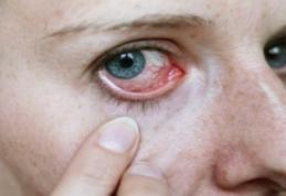 Afecțiuni care pot fi detectate printr-o simplă analiză a ochilor