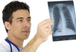 Toți fumătorii trebuie să știe asta. Cel mai bun remediu natural pentru curățarea plămânilor