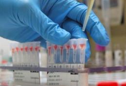 De ce rezultatele analizelor diferă de la un laborator la altul