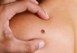 Boala care nu doare, dar te ucide în mai puțin de un an