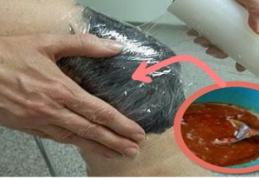 Ai probleme cu articulațiile? Folosește acest amestec natural