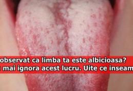 Ai observat că limba ta este albicioasă? Nu mai ignora acest lucru. Uite ce înseamnă