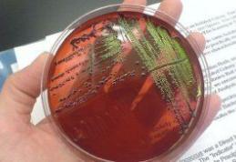 Care sunt simptomele infectării cu E.coli şi cum ne putem proteja