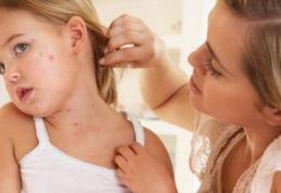 ATENȚIE! Acestea sunt primele simptome ale RUJEOLEI. Mergi de urgenţă la medic cu copilul tău!