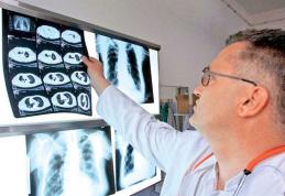  Cat sunt de nocive sunt radiografiile?