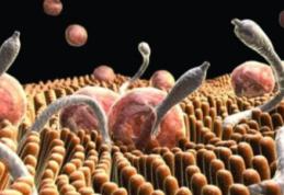 Cum poţi să scapi de paraziţii din corpul tău fără medicamete