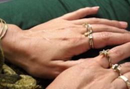 Şi tu porţi bijuterii de aur? Boală curată pentru trei organe vitale