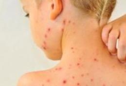 Epidemie de rujeolă în 32 de județe: 7 decese, 1.700 de cazuri confirmate. Ce măsuri vor lua autoritățile?