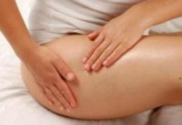 Vergeturile, o problemă delicată. Cum o tratezi?