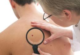 Medicii trag un semnal de alarmă: Ce sunt, de fapt, aluniţele roşii care apar pe corp