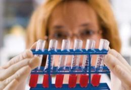 Poți avea chiar tu hepatita C, fără să știi