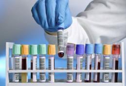 Cât costă cele mai importante analize de sânge