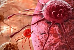 Medicii trag un semnal de alarmă: Lipsa acestei vitamine duce la apariţia cancerului!