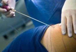 O liposucție făcută în Italia i-a pus capăt zilelor unei tinere românce