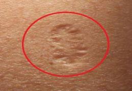 Ai și tu acest semn pe braţ? Uite care este adevărata lui semnificaţie