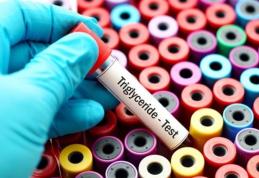 Ce sunt, de fapt, trigliceridele. Toţi medicii ar trebui să recunoască acest lucru!