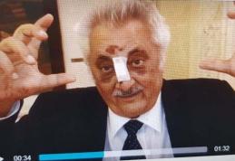 Nicolae Bacalbaşa, dus de urgenţă la spital! Are nasul rupt, un dinte spart şi e rănit la cap