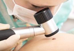 Ce faci când ți se rupe o aluniță