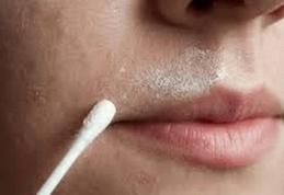 Tratament naturist pentru combaterea pilozitatii excesive